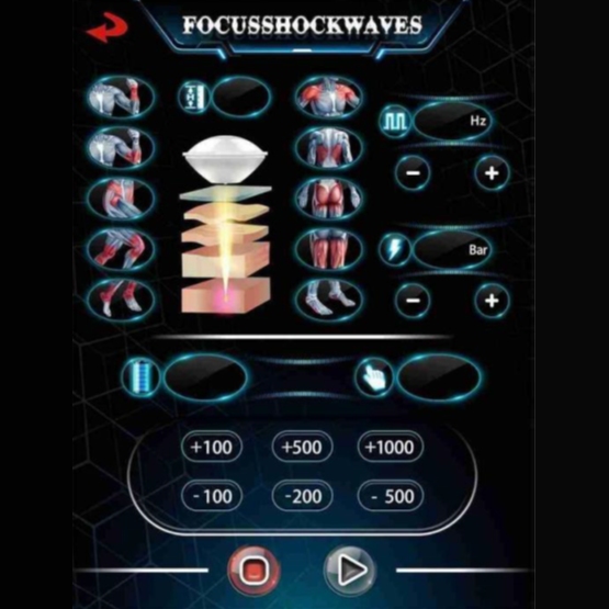 Focus Shockwaves – Fókuszált lökéshullámterápiás készülék